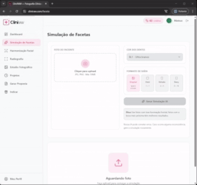Simulador de Facetas
